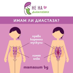 Read more about the article Диастаза – дупката в корема, която всяка четвърта жена има!